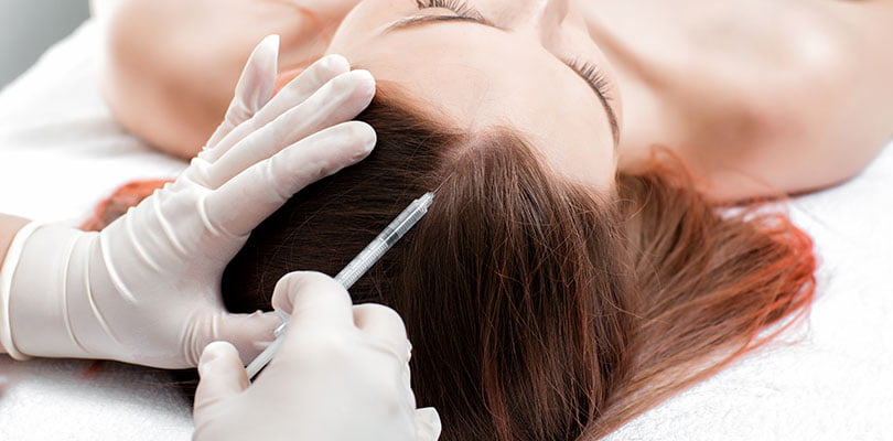 Hair Loss Treatments