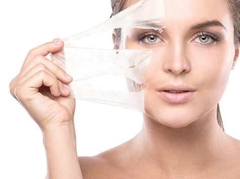 CHEMICAL PEEL TREATMENT