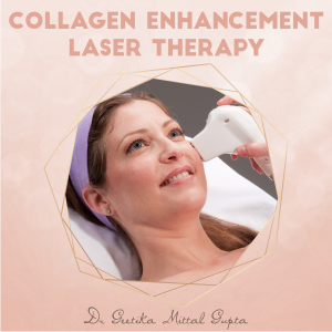 Collagen Enhancement Laser Therapy