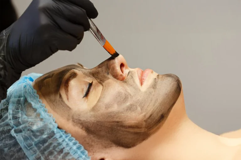 Carbon Laser Facial in Mumbai