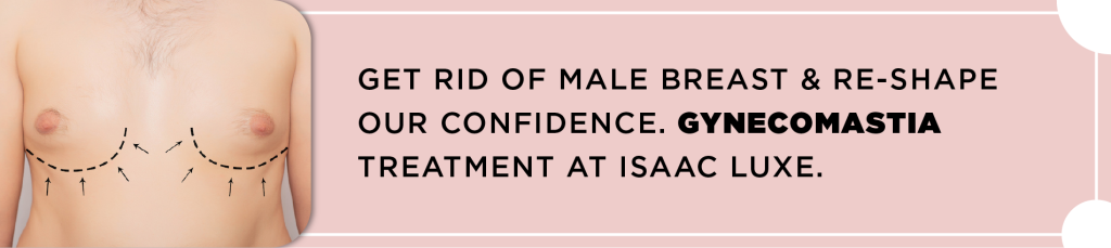 gynecomastia treatment