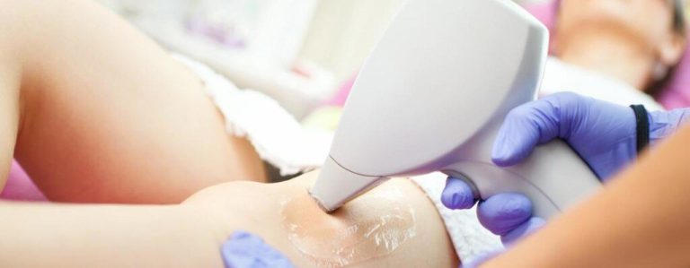 Laser Hair Removal Treatment