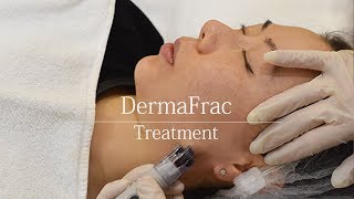 Dermafrac Microneedling Treatment