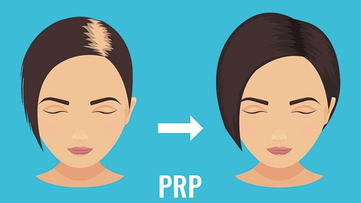 PRP Treatment In Bangalore - Isaac Luxe
