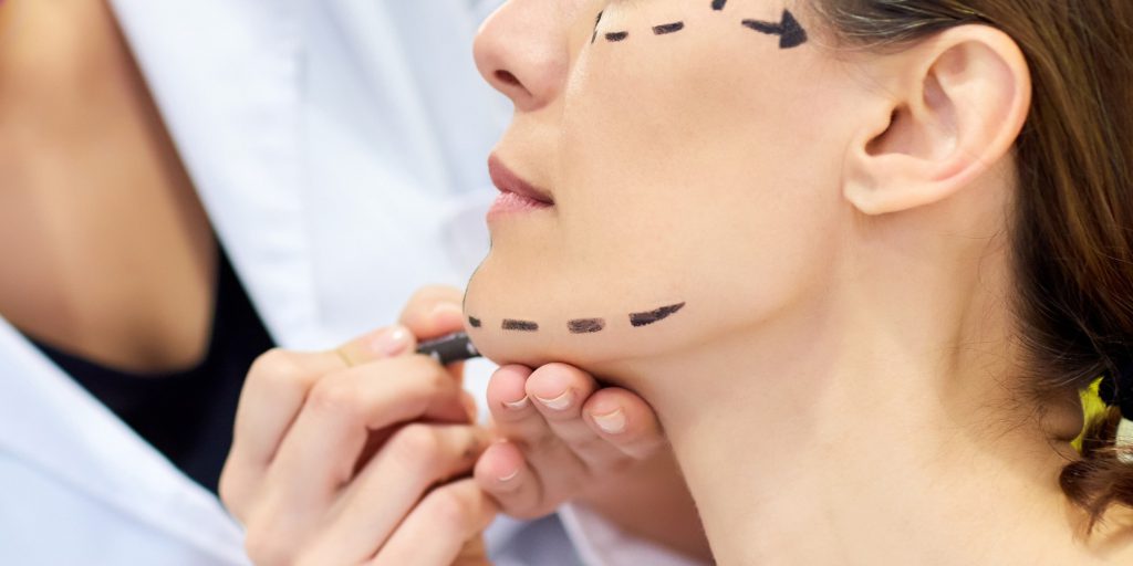 face-lift
