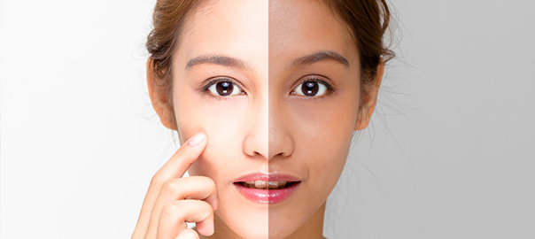 Tribeam Skin Lightening in Delhi