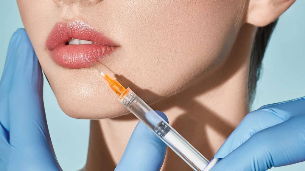 What-is-a-lip-filler