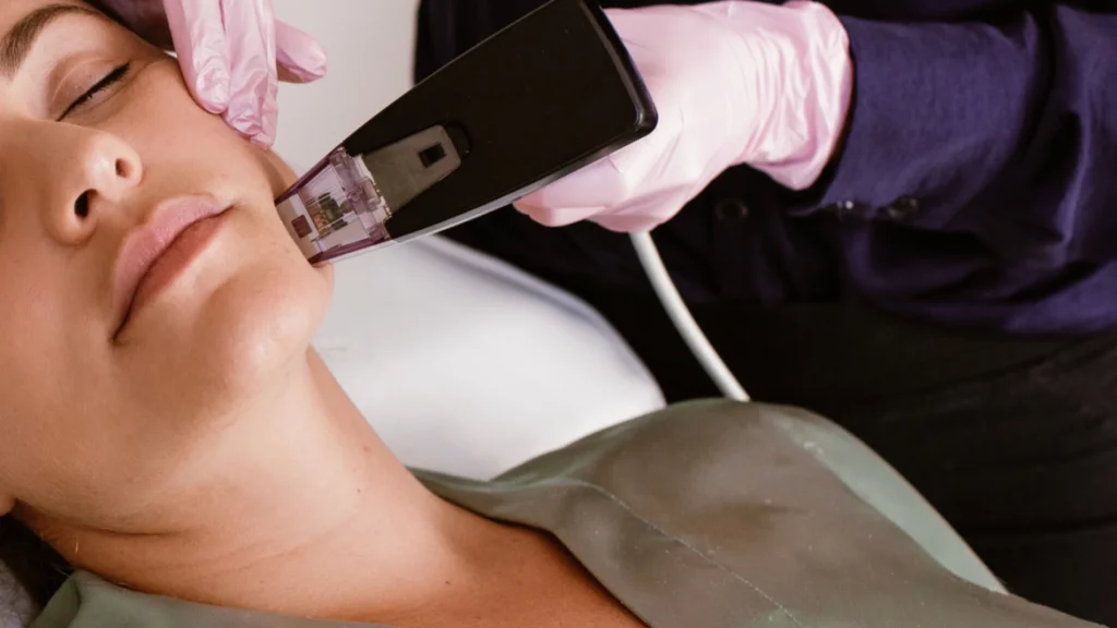 Skin Tightening Laser Treatment