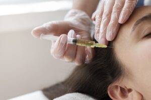 close-up-woman-getting-prp-treatment (1)