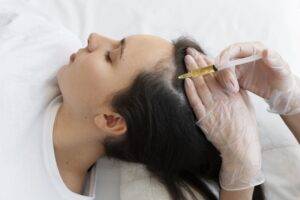 woman-getting-scalp-prp-treatment-high-angle (1)