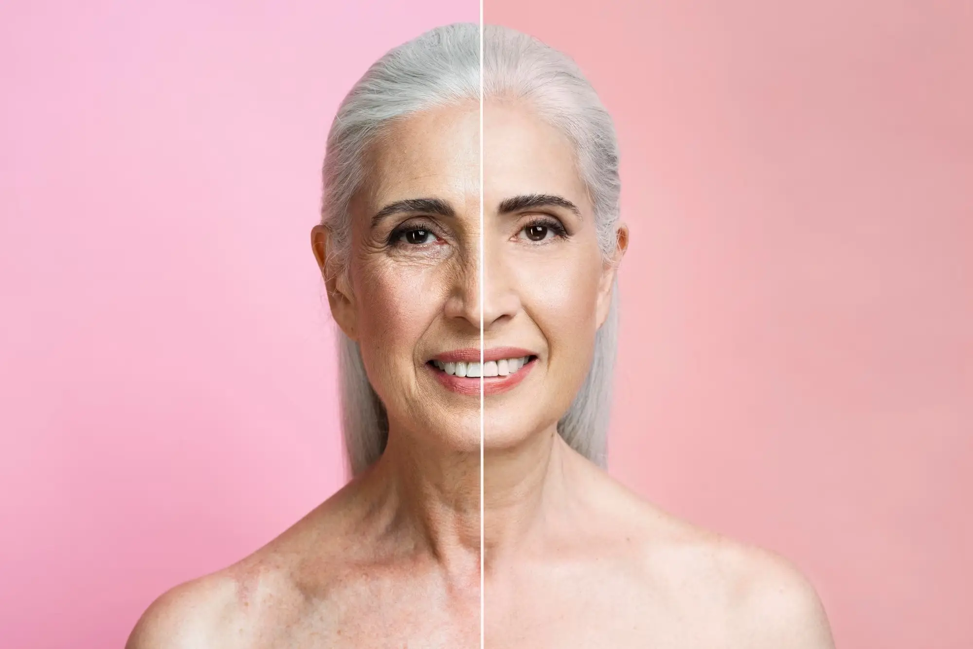 Post treatment care after getting Emface