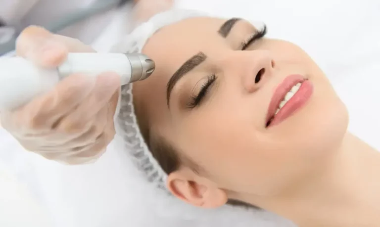 V-Erase Treatment – Advanced MNRF Treatment for Acne Scars