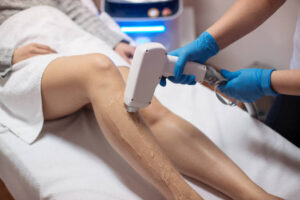 Laser Hair Reduction Treatment