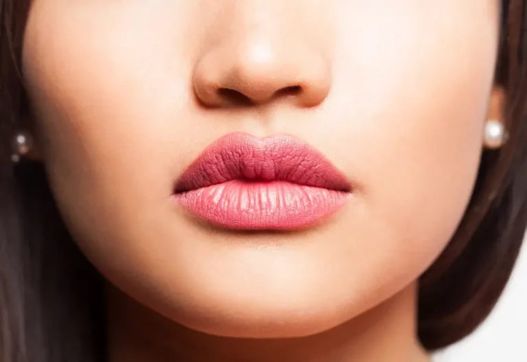 How Lip Fillers Can Change Your Face