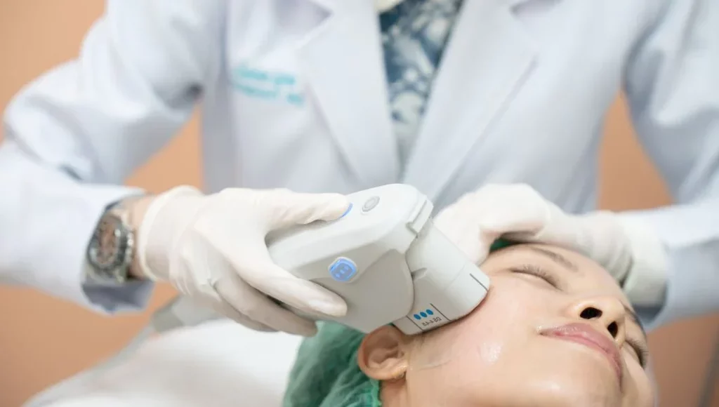 Ultherapy treatment