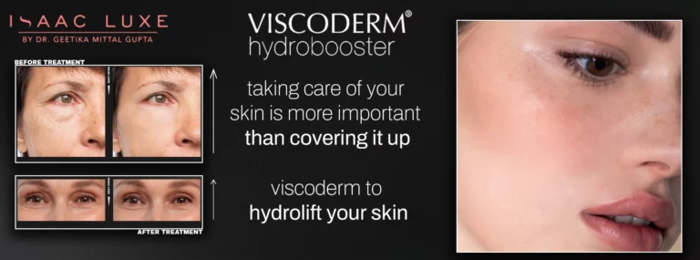 The Science of Skin Boosters: What Viscoderm Hydrobooster Can Do for You