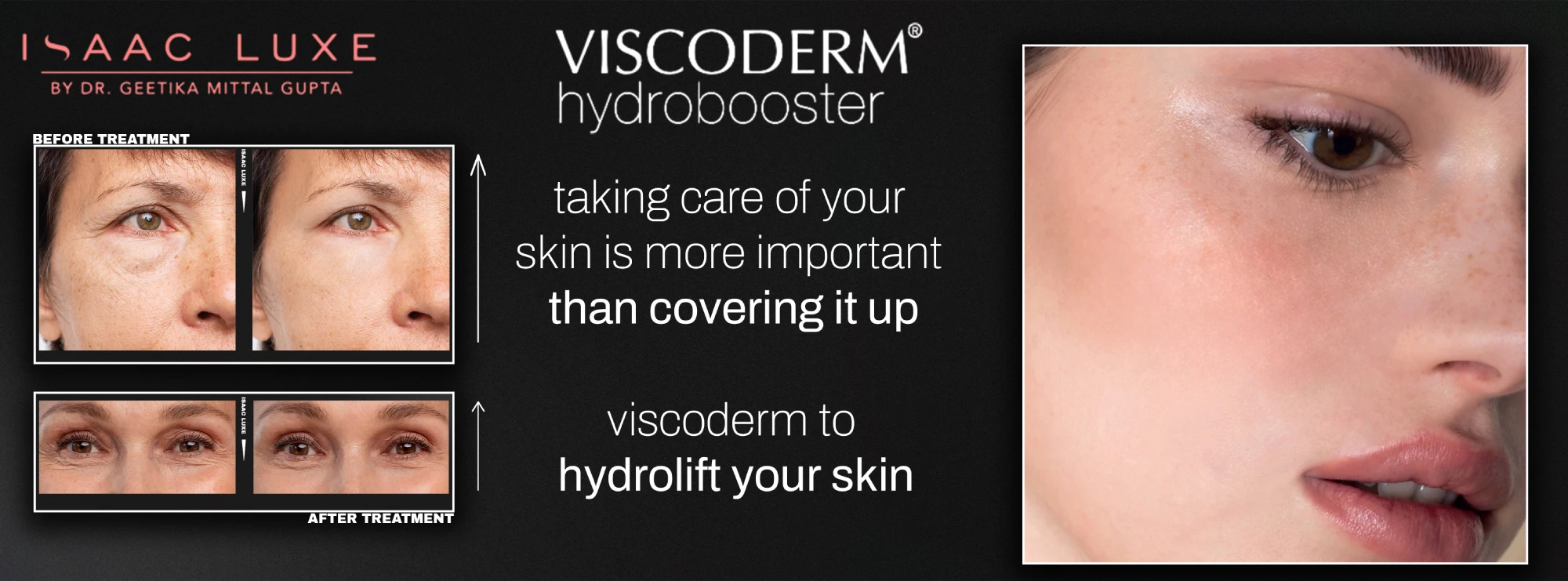 Viscoderm Hydrobooster