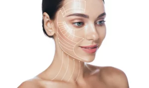 Hydrafacial treatment