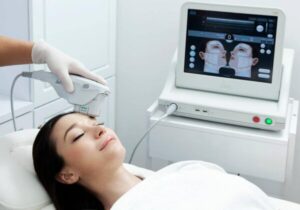 Ultherapy treatment