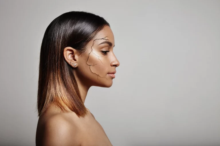 The Top Treatments for Dry Skin