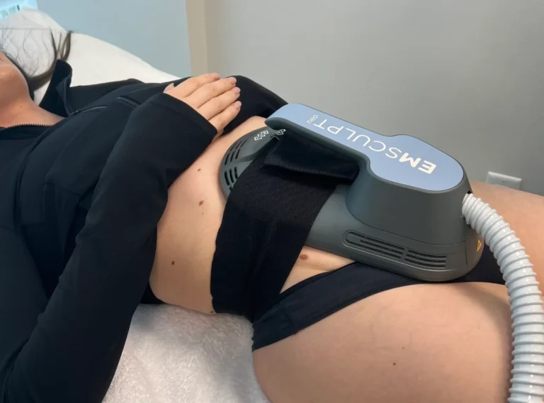 Emsculpt NEO Side Effects: Are There Any