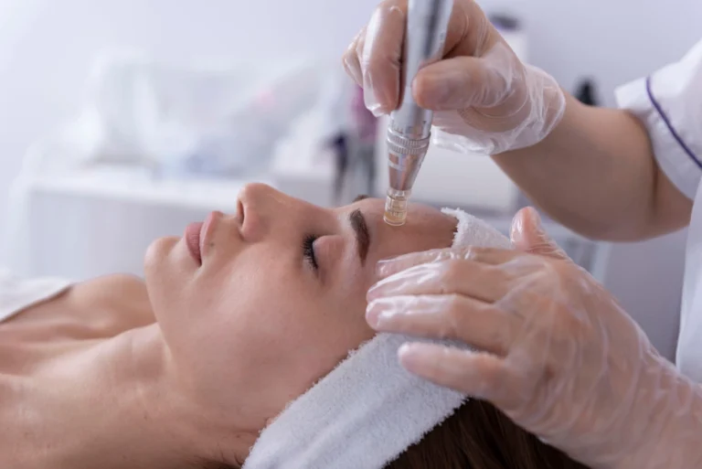 Everything You Need to Know About Dermapen