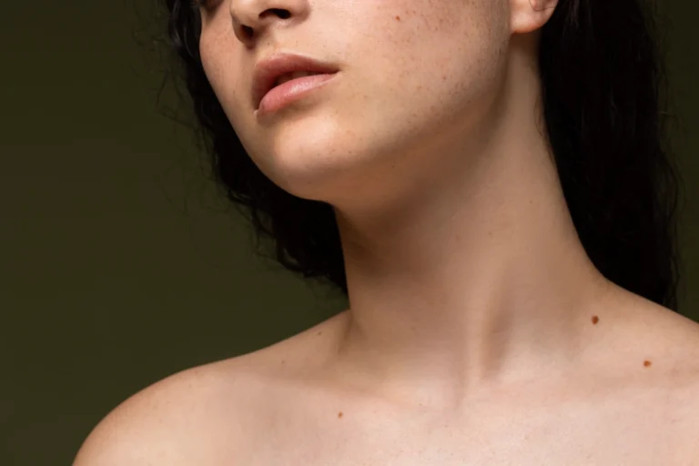five Ways to Get Rid of Pesky Dark Spots