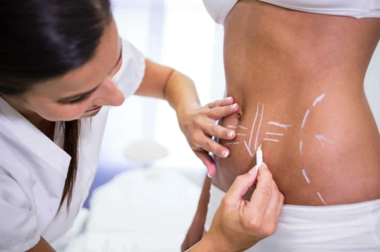 Cryolipolysis vs. CoolSculpting: What’s the Difference?