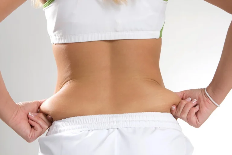 Remove Love Handles With CoolSculpting