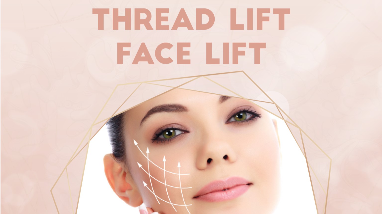 Thread Face Lift Treatment in Delhi - Non-Surgical Facelift - Isaac Luxe