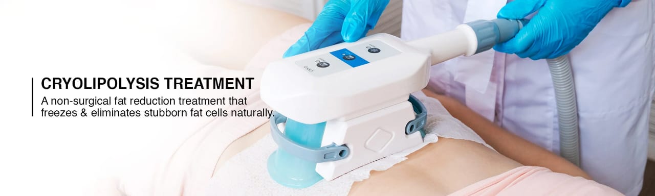 Cryolipolysis Treatment