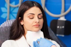 CoolSculpting for Submental Fat