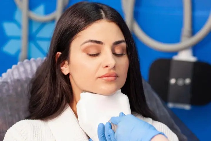 CoolSculpting for Submental Fat