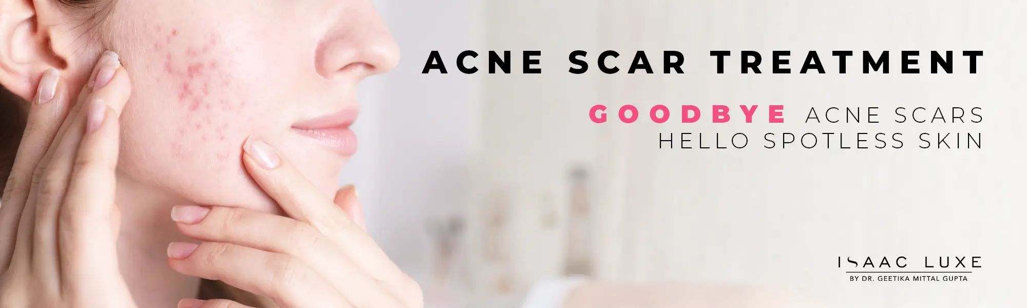Acne Treatment