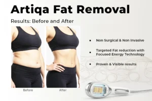 Artiqa Before and after